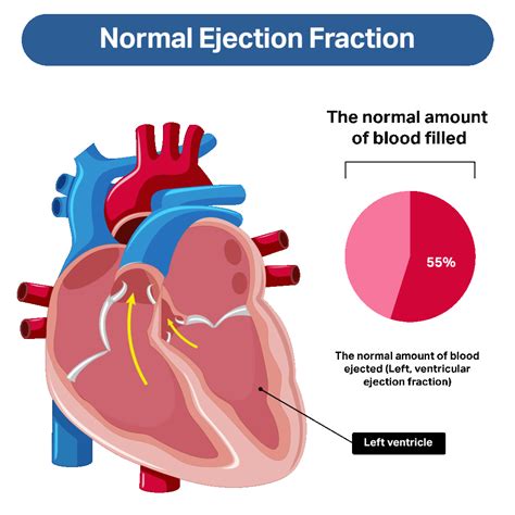 Understanding Low Ejection Fraction: Causes, Risks, and Treatment Options