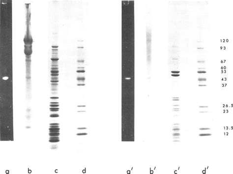 Low Ionic Strength Electrophoresis