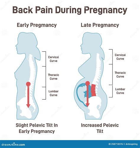 Relieving Lower Back Pain While Pregnant: Effective Solutions for Expectant Moms