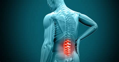 Understanding Lumbar Decompression Surgery: Is It Right for Your Back Pain?