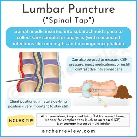Lumbar Puncture Nursing Interventions Guide