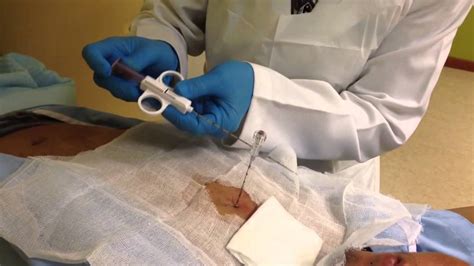 Understanding the Lung Biopsy Procedure: What to Expect and Why It's Done