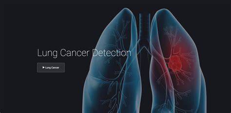 Report RI, Mass. rank high in lung cancer earlydetection