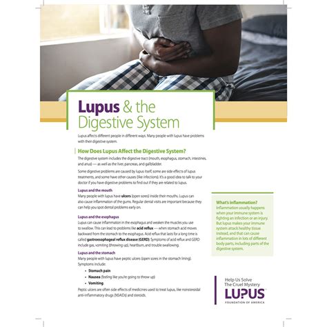 Image result for lupus symptoms in women Sjogrens syndrome, Sjogrens