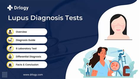 lupus test code