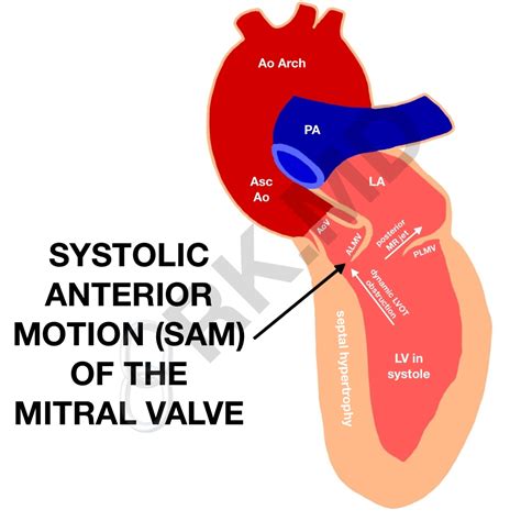 lv medical abbreviation heart