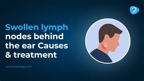 Lymph Node Behind Ear Swollen: Causes and Treatment Options