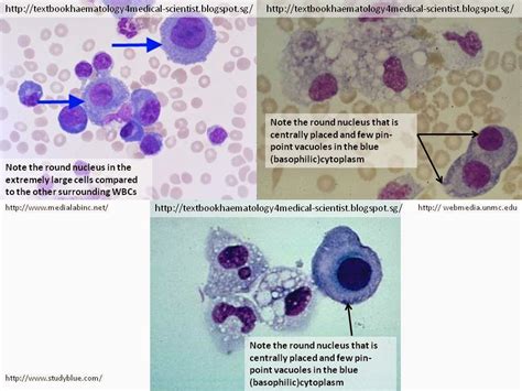 macrophage vs mesothelial cell