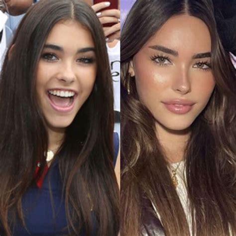 madison beer without plastic surgery