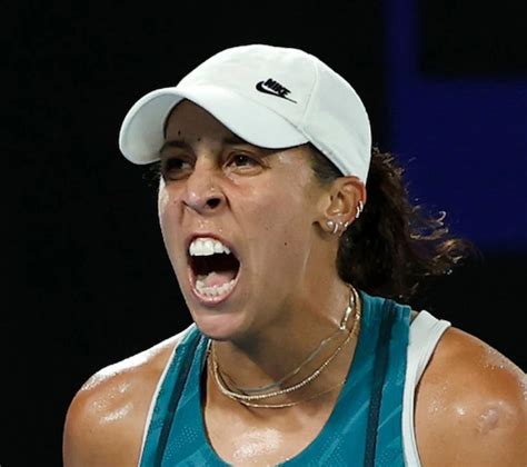madison keys teeth before