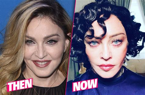 madonna new facelift before and after