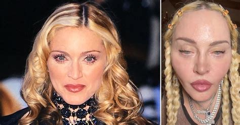 madonna plastic surgery face 2023