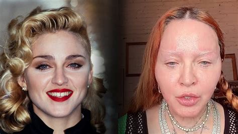 madonna post plastic surgery