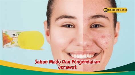 Madu menghilangkan bekas jerawat