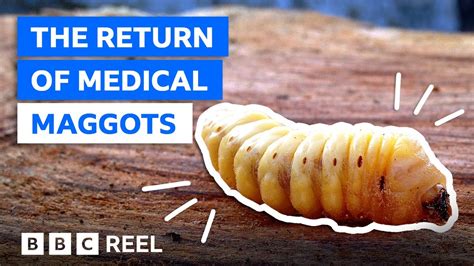 Cool Maggots As Medicine Answer Key Update