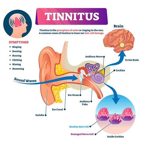 Main Causes Of Tinnitus