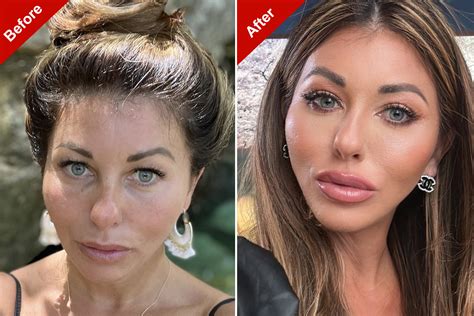 Makeup Day Of Surgery