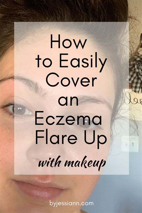 Makeup On Eczema