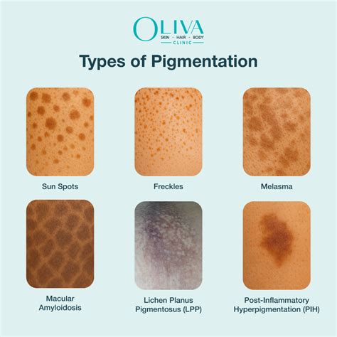Makeup Pigmentation Test