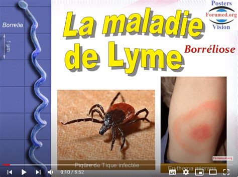 maladie de lyme contagieux