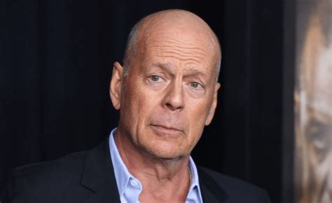 malattia di bruce willis