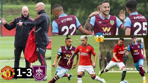 man united burnley friendly