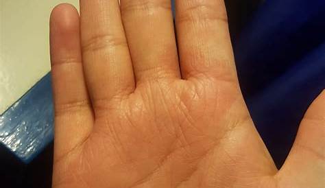 5 Consejos prácticos para eliminar las manchas de las manos - Salud y