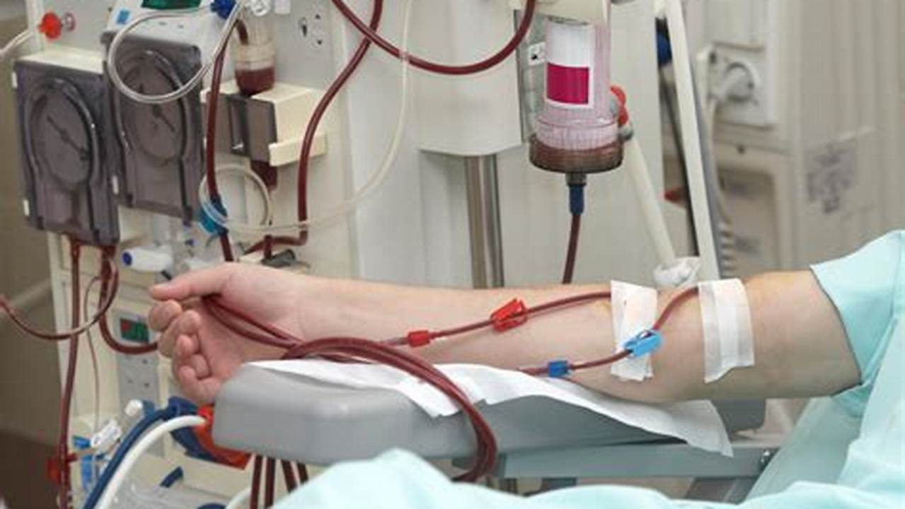 Temukan Manfaat Cuci Darah untuk Penderita Ginjal yang Jarang Diketahui