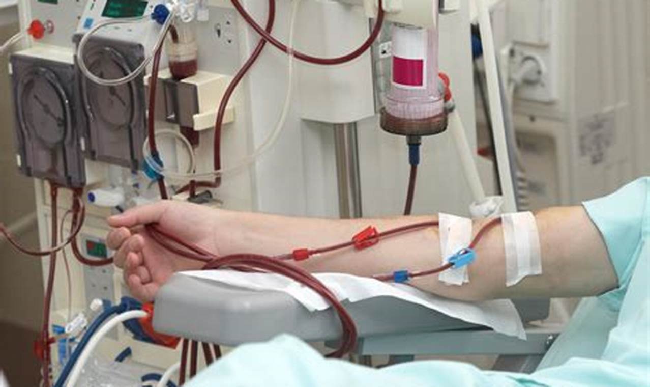 Temukan Manfaat Cuci Darah untuk Penderita Ginjal yang Jarang Diketahui