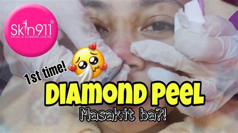 10 Manfaat Diamond Peel yang Jarang Diketahui, Wajib Dicoba!