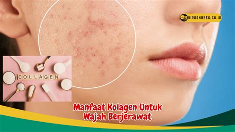 Manfaat Kolagen untuk Wajah Berjerawat, Rahasia Kulit Sehat!