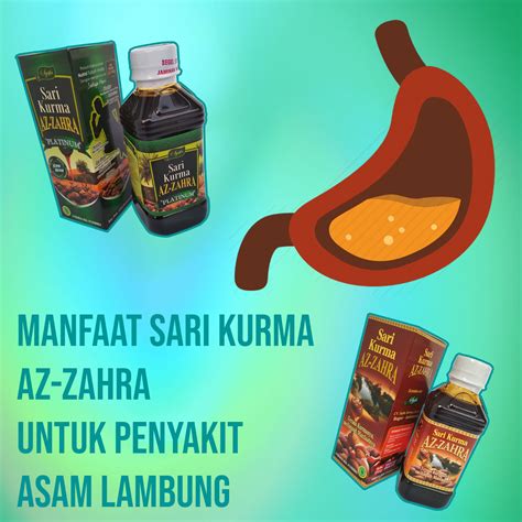 Temukan Manfaat Kurma untuk Asam Lambung yang Tak Terduga