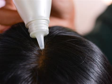 Temukan Manfaat Menggunakan Hair Tonic Yang Perlu Anda Tahu