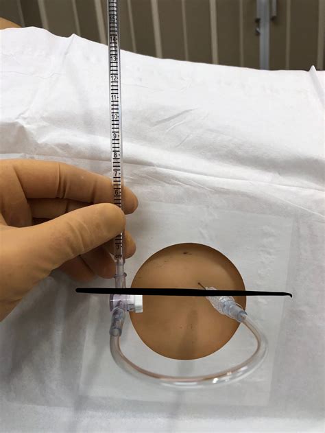 Manometer Lumbar Puncture