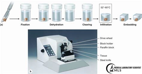 manual tissue processing procedure