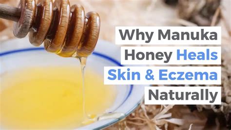 manuka honey benefits for skin eczema