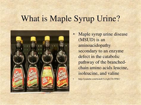 Maple Syrup Urine Disease Lab Values