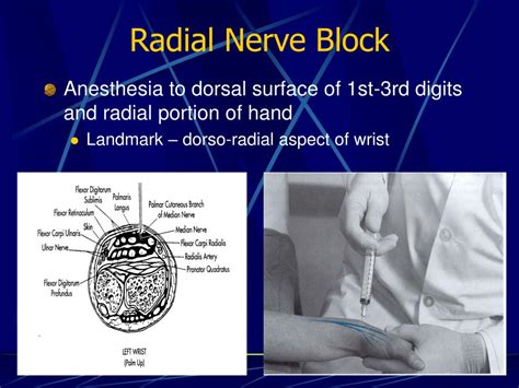 marcaine cpt code for nerve block