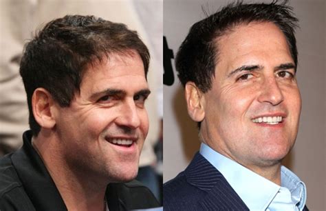 mark cuban plastic surgery