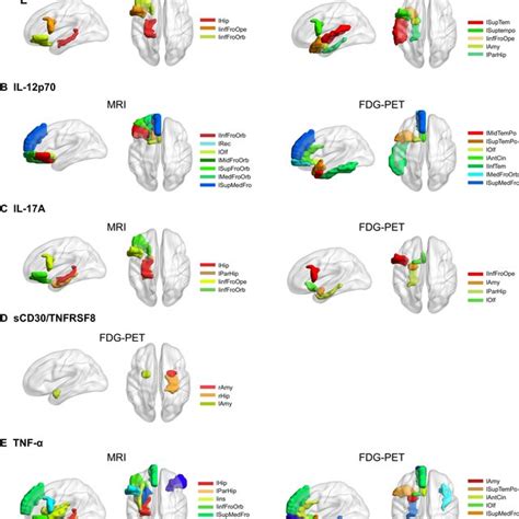 Markers For Brain Inflammation