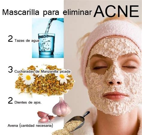 mascarilla natural para el acne