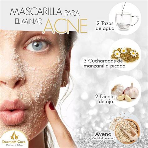 mascarilla para el acne casera