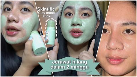 maskeran jerawat