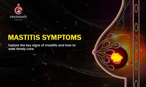 PPT Mastitis PowerPoint Presentation, free download ID2035341