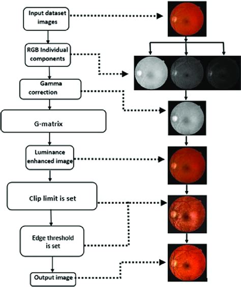 Matlab Clahe Algorithm