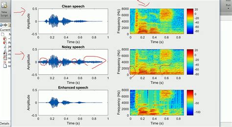 Matlab Filter Electrical Noise