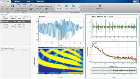 Matlab Signal Processing Toolbox List Of Functions