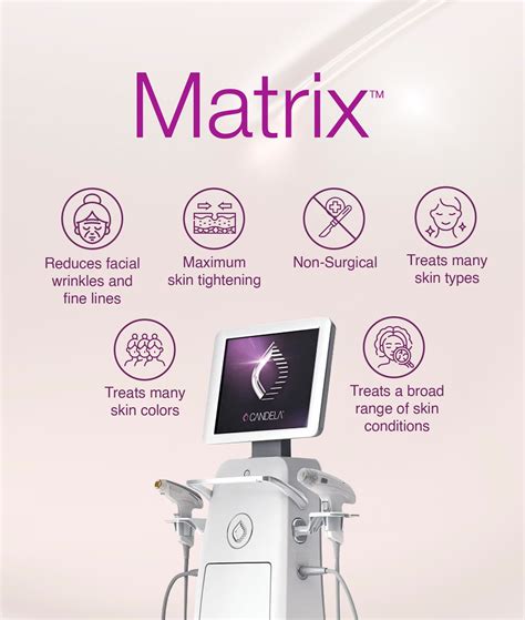 Matrix Rf Reviews