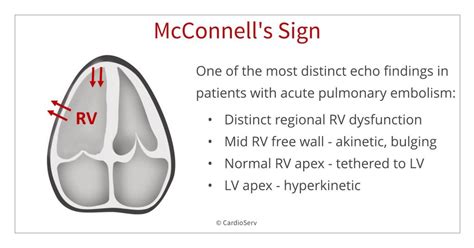 mcconnell sign sensitivity and specificity