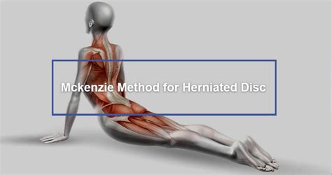 mckenzie method exercises for herniated disc